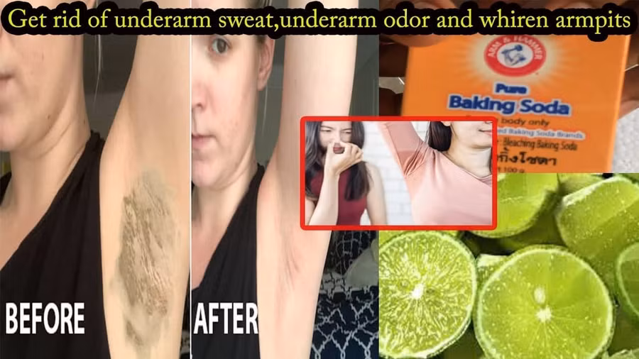 Mẹo khử mùi hôi vùng nách không cần thuốc xịt ảnh 1