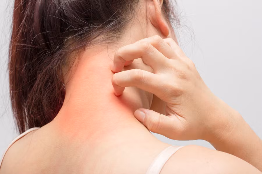 Sức khỏe - Đi du lịch đừng quên mang theo những loại thuốc này (Hình 4).