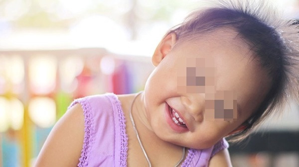 Vì sao trẻ con hay tự giật tóc của mình?