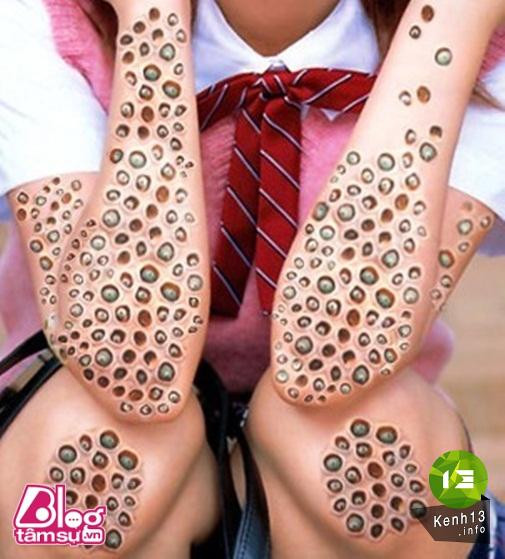 Nhũng bức ảnh khiến bạn rùng mình, toát mồ hôi ảnh 3 hinh-anh-rung-ron-blogtamsu (13)