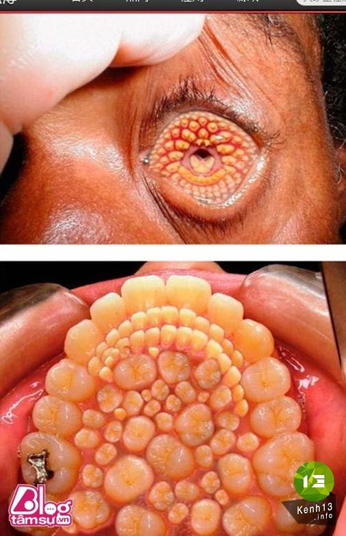 Nhũng bức ảnh khiến bạn rùng mình, toát mồ hôi ảnh 10 hinh-anh-rung-ron-blogtamsu (6)