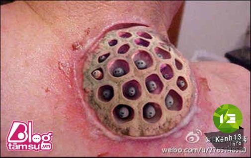 Nhũng bức ảnh khiến bạn rùng mình, toát mồ hôi ảnh 12 hinh-anh-rung-ron-blogtamsu (5)