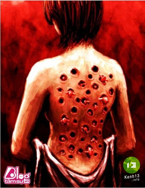 Nhũng bức ảnh khiến bạn rùng mình, toát mồ hôi ảnh 6 hinh-anh-rung-ron-blogtamsu (11)