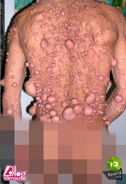 Nhũng bức ảnh khiến bạn rùng mình, toát mồ hôi ảnh 1 hinh-anh-rung-ron-blogtamsu (17)