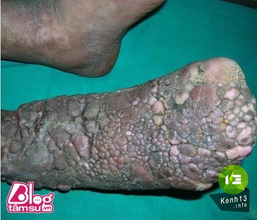 Nhũng bức ảnh khiến bạn rùng mình, toát mồ hôi ảnh 15 hinh-anh-rung-ron-blogtamsu (3)