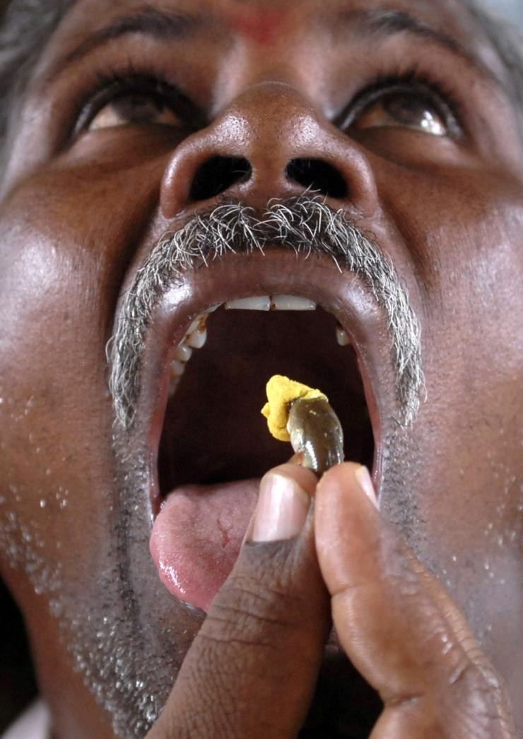 Dùng đỉa, giòi để chữa bệnh ảnh 5