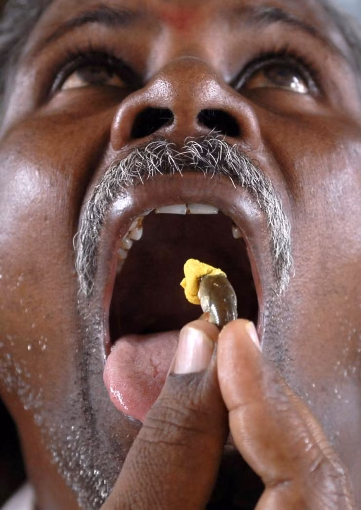 Dùng đỉa, giòi để chữa bệnh ảnh 5