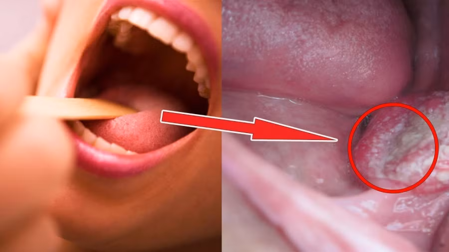 nhung-van-de-rang-mieng-khong-nen-bo-qua-phunutoday0