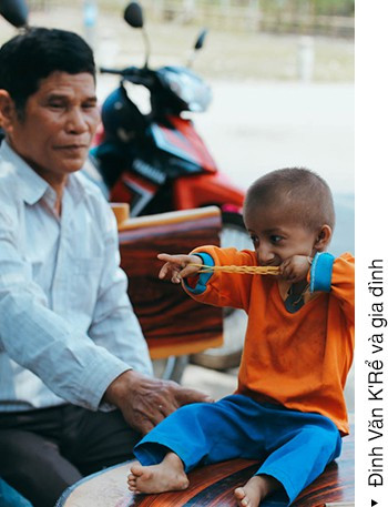 Chuyện cổ tích có thật về người thầy hiệu trưởng - cha nuôi của cậu bé tí hon 10 tuổi chỉ nặng 3,9 kg - Ảnh 11. Chuyện cổ tích có thật về người thầy hiệu trưởng - cha nuôi của cậu bé tí hon 10 tuổi chỉ nặng 3,9 kg - Ảnh 11.