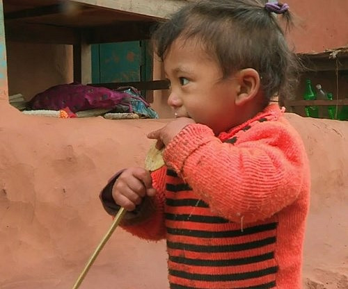 Bé trai Nepal mọc cánh tay ở... lưng - Hình 1