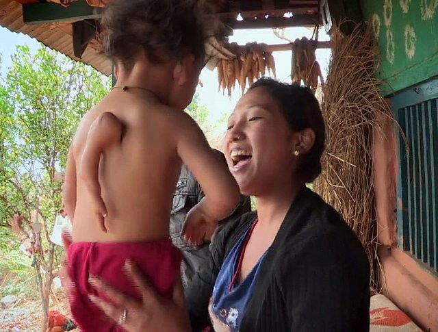 Bé trai Nepal mọc cánh tay ở... lưng - Hình 2