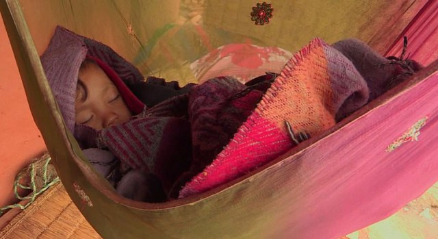 Bé trai Nepal mọc cánh tay ở... lưng - Hình 5