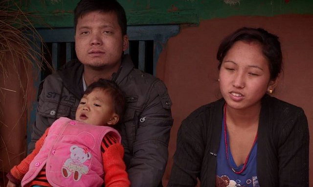Bé trai Nepal mọc cánh tay ở... lưng - Hình 3