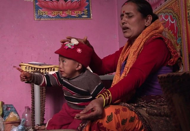 Bé trai Nepal mọc cánh tay ở... lưng - Hình 6