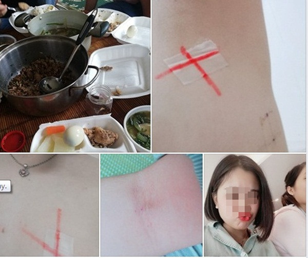 Cô gái 22 tuổi bị ung thư: “Nếu biết sắp ra đi, bạn sẽ làm gì với thời gian còn lại?”