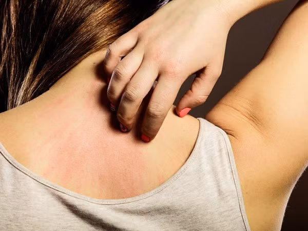 Ngứa hoài không dứt: Cảnh giác với 7 bệnh chết người ảnh 1