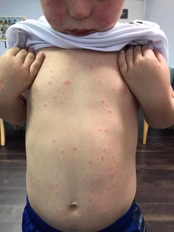 con trai bi bo ve can, bac si noi benh nhe, me tim hieu phat hien cuc nguy hiem - 1