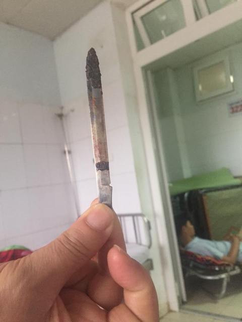 Lưỡi dao được các bác sĩ phẫu thuật lấy ra, dài 13cm, đã hoen gỉ. Lưỡi dao được các bác sĩ phẫu thuật lấy ra, dài 13cm, đã hoen gỉ.
