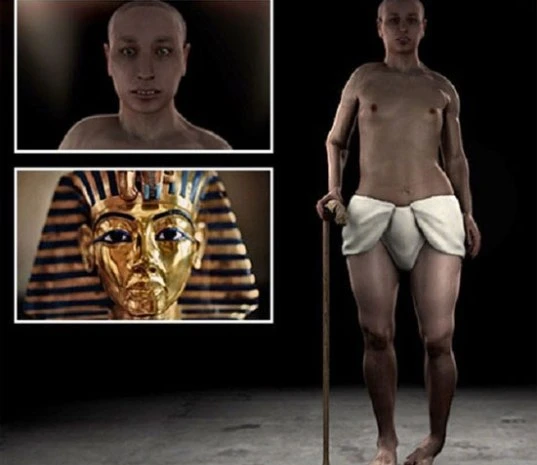 Pharaoh Tutankhamun răng hô, chân khoèo?