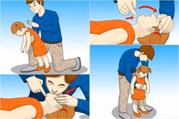 Hút trà sữa quá mạnh, cô gái... tử vong