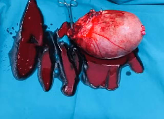 U xơ có kích thước khoảng 20cm và nặng 7,5kg