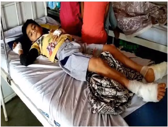 Ba người trong một gia đình bị bỏng vì smartphone bất ngờ phát nổ khi đang sạc-3