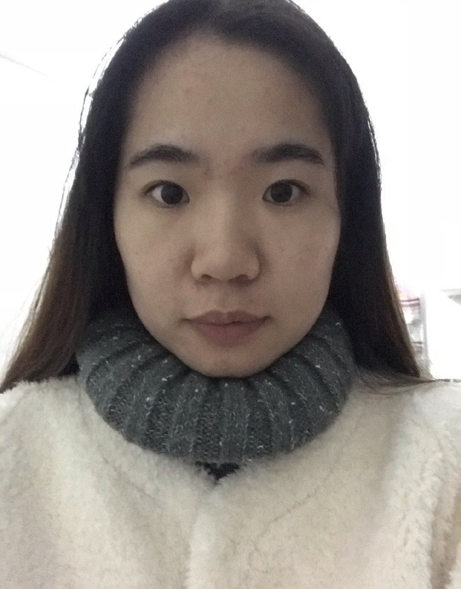 Chùm ảnh trước và sau khi photoshop khiến con trai đồng loạt ngả mũ vì quá vi diệu - Ảnh 9. Chùm ảnh trước và sau khi photoshop khiến con trai đồng loạt ngả mũ vì quá vi diệu - Ảnh 9.