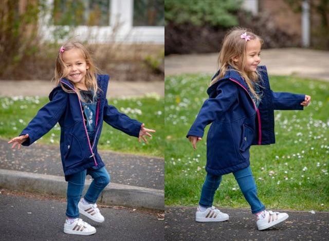 Bé gái chào đời với đôi chân gập hẳn về phía trước giờ ra sao? ảnh 4 be gai chao doi voi doi chan gap han ve phia truoc gio ra sao sau 3 nam? - 4