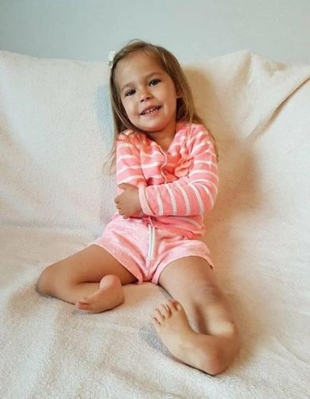 Bé gái chào đời với đôi chân gập hẳn về phía trước giờ ra sao? ảnh 1 be gai chao doi voi doi chan gap han ve phia truoc gio ra sao sau 3 nam? - 1