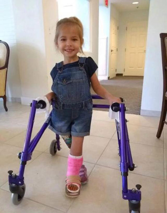 Bé gái chào đời với đôi chân gập hẳn về phía trước giờ ra sao? ảnh 3 be gai chao doi voi doi chan gap han ve phia truoc gio ra sao sau 3 nam? - 3