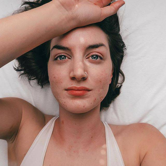 Bạn có biết: Tẩy da chết sai cách sẽ khiến da càng nhanh lão hóa hơn - Ảnh 2. Bạn có biết: Tẩy da chết sai cách sẽ khiến da càng nhanh lão hóa hơn - Ảnh 2.