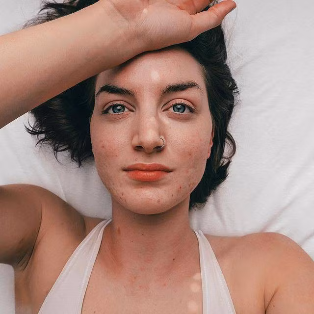 Bạn có biết: Tẩy da chết sai cách sẽ khiến da càng nhanh lão hóa hơn - Ảnh 2.