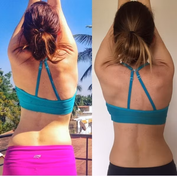 Doctors Recommend Lifting Your Arms Overhead More Often, and Here Are9 Reasons Why - 1