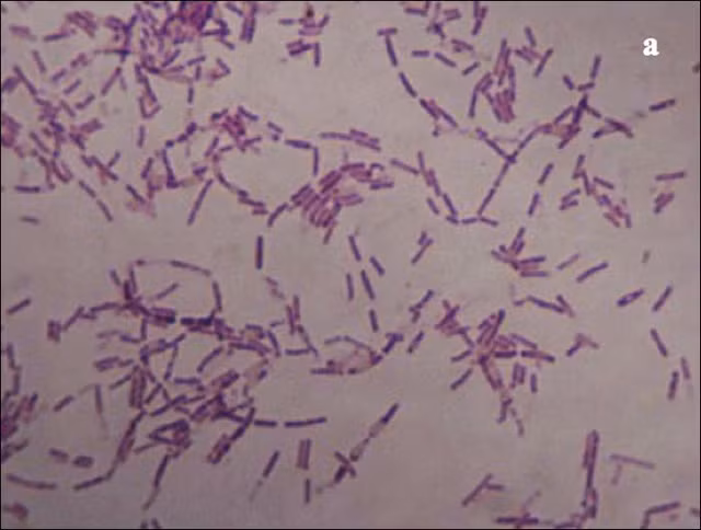  Vi khuẩn Bacillus F 