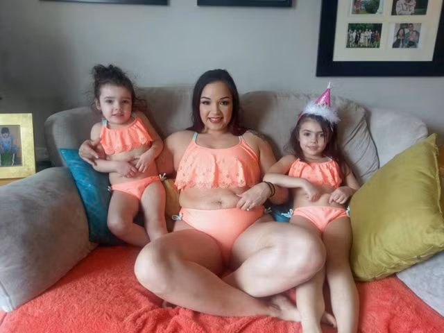 Khoe bụng rạn sau sinh, bà mẹ vụt thành sao sáng trong 1 đêm ảnh 2