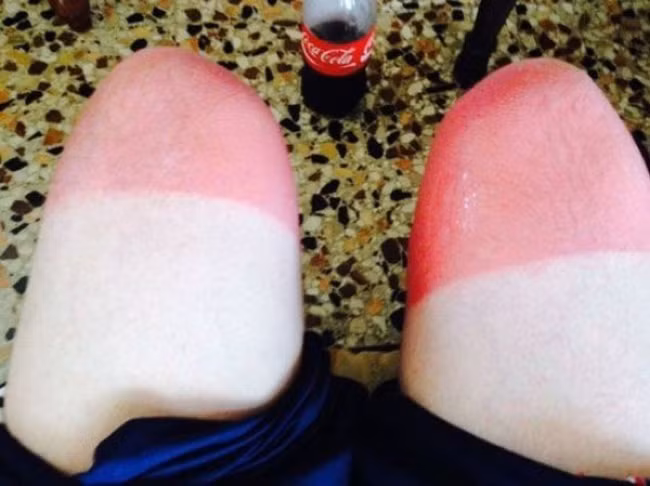 tinh co "chop" nhung khoanh khac hai huoc day bat ngo hinh anh 3