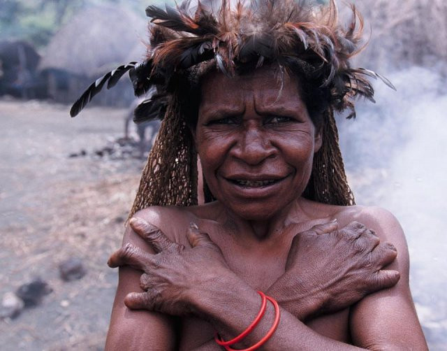 Hủ tục cắt ngón tay man rợ của bộ tộc Dani ở Indonesia ảnh 4 Hủ tục cắt ngón tay man rợ của bộ tộc Dani ở Indonesia - Hình 4