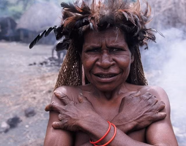 Hủ tục cắt ngón tay man rợ của bộ tộc Dani ở Indonesia - Hình 4