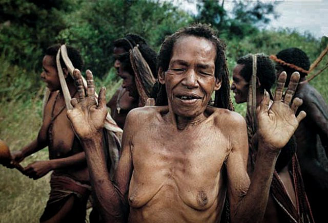 Hủ tục cắt ngón tay man rợ của bộ tộc Dani ở Indonesia ảnh 3 Hủ tục cắt ngón tay man rợ của bộ tộc Dani ở Indonesia - Hình 3