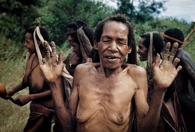 Hủ tục cắt ngón tay man rợ của bộ tộc Dani ở Indonesia - Hình 3