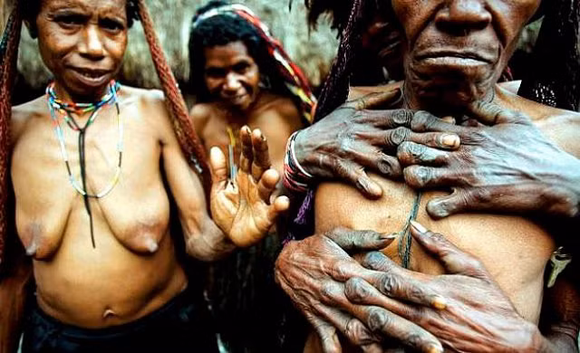 Hủ tục cắt ngón tay man rợ của bộ tộc Dani ở Indonesia - Hình 2