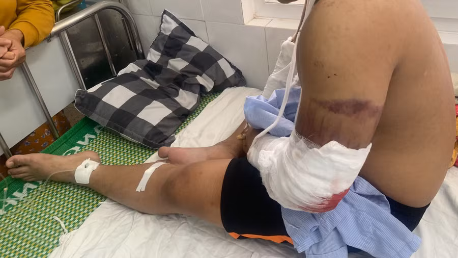 Shipper Đạt đang được điều trị tại Bệnh viện Quân y C17 (Đà Nẵng).