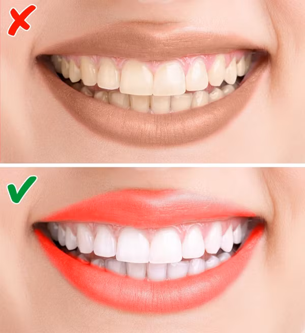 7. Chọn theo màu răng Nếu có hàm răng trắng, bạn có thể đánh đa phần tất cả các màu son hợp với sắc tố da.Nếu có hàm răng vàng, nên chọn màu hoa hồng, màu cam hoặc đỏ nhạt. Tránh màu đỏ tươi, tím hoặc nâu.