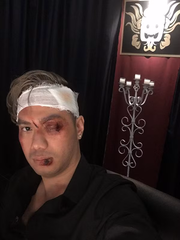 Diễn viên Việt Anh gây chú ý khi chia sẻ bức ảnh anh được hóa trang với nhiều vết thương lớn trên gương mặt. Theo tiết lộ của một diễn viên, Người phán xử bản ngoại truyện dự kiến sẽ có nhiều cảnh đánh đấm, chém giết chân thực hơn so với phiên bản truyền hình.