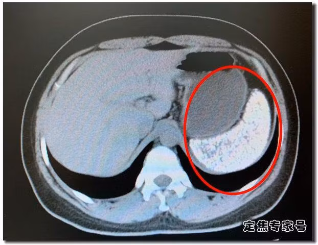 la lach cua co gai 28 tuoi nhu vien gach ro, bac si hai hung khi biet ly do - 2