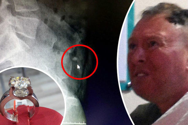 Kết cục bất ngờ cho kẻ nuốt trộm nhẫn kim cương gần 1 tỷ ảnh 1 Kết cục bất ngờ cho kẻ nuốt trộm nhẫn kim cương gần 1 tỷ