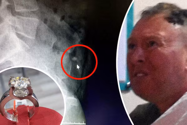 Kết cục bất ngờ cho kẻ nuốt trộm nhẫn kim cương gần 1 tỷ ảnh 1 Kết cục bất ngờ cho kẻ nuốt trộm nhẫn kim cương gần 1 tỷ