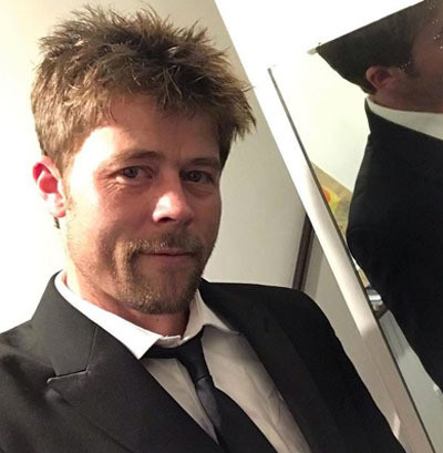 Được mời dự sự kiện, Nathan bắt đầu để râu nhưng nói sẽ không phẫu thuật thẩm mỹ. Ảnh: Mirror.