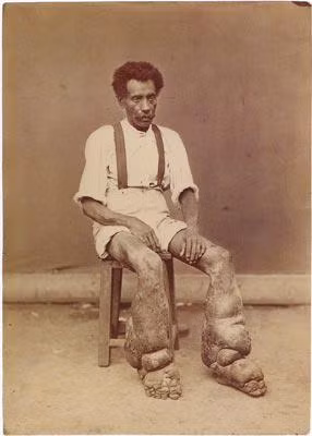 Hiện tượng quái dị, bí ẩn y học, chuyện lạ 4 phương