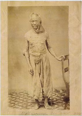 Hiện tượng quái dị, bí ẩn y học, chuyện lạ 4 phương